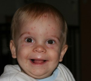 benhnhungvui benhnhungvui