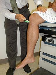 neuro_patellar_reflex